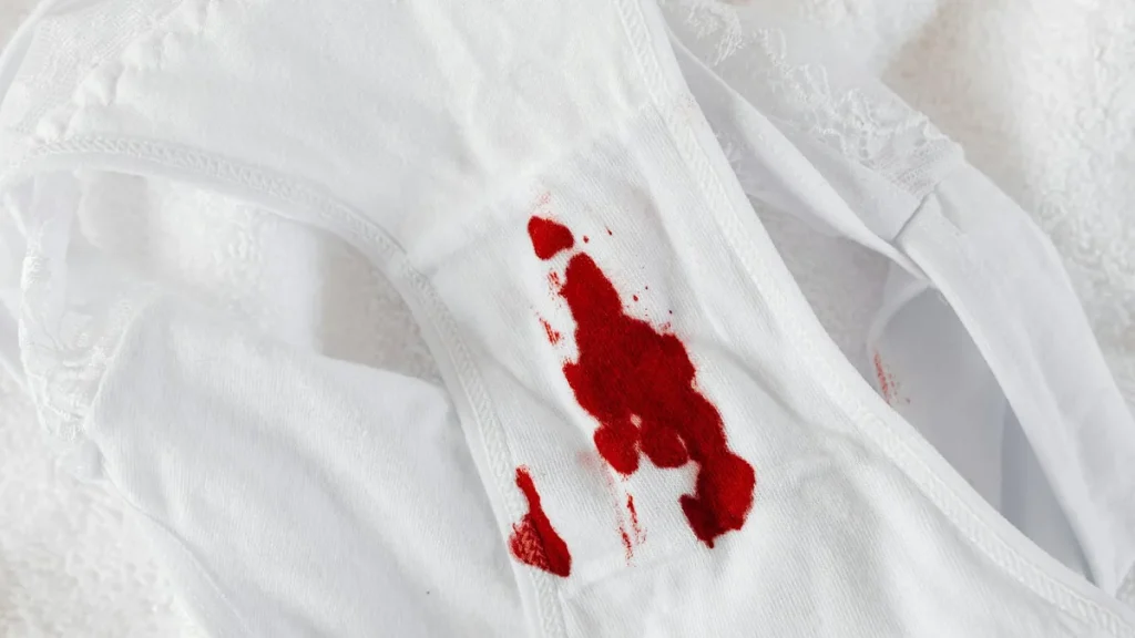 Stains 101: A Simple, Stress-Less Plan for Treating Clothes, Carpets, and Upholstery
